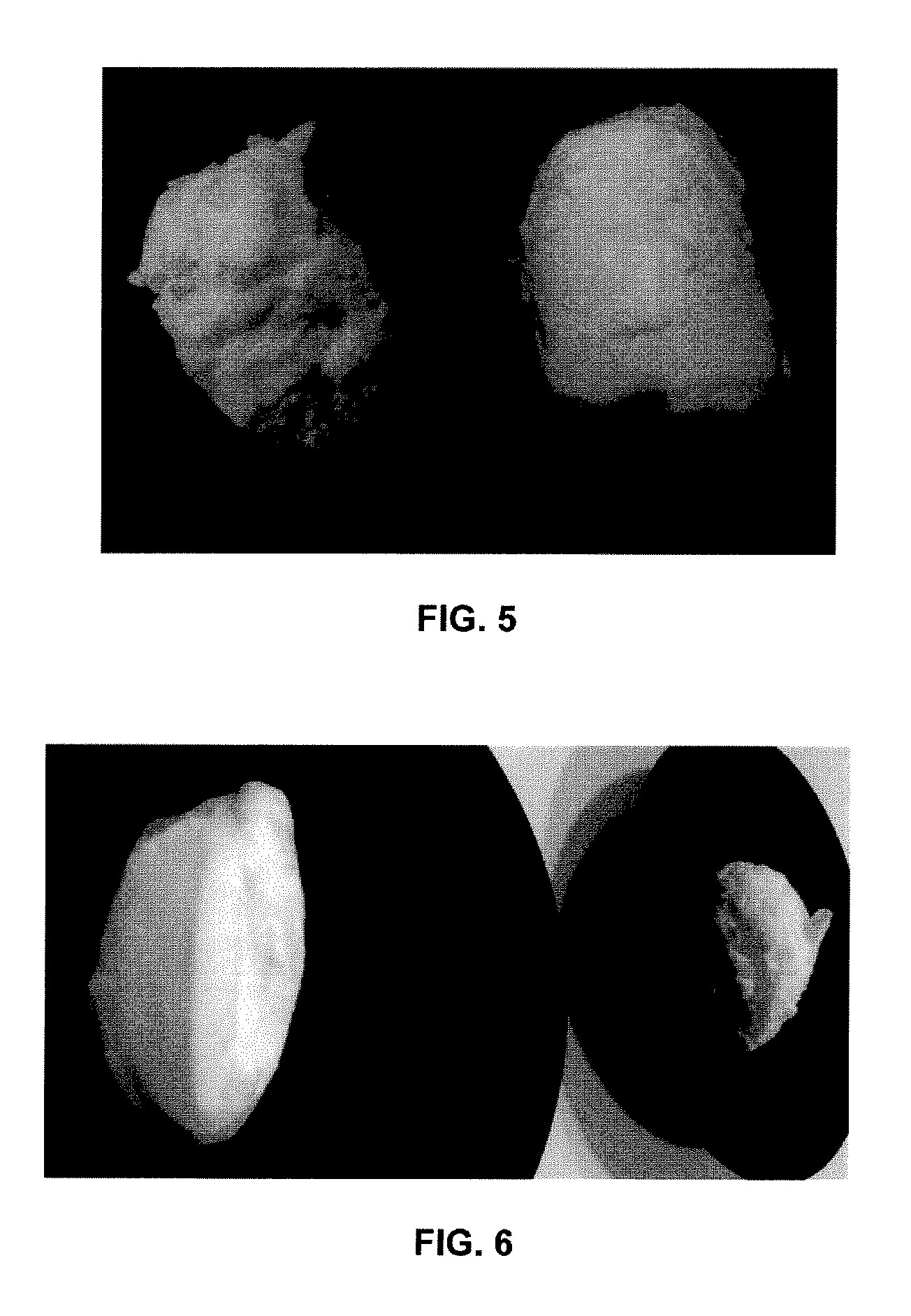 Healthy food compositions having gel or foam textures and comprising hydrolyzed egg products