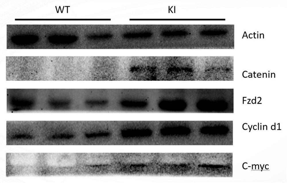 Application of Wnt inhibitor Wnt-C59 in preparation of medicine for treating dilated cardiomyopathy caused by SCN5A mutation