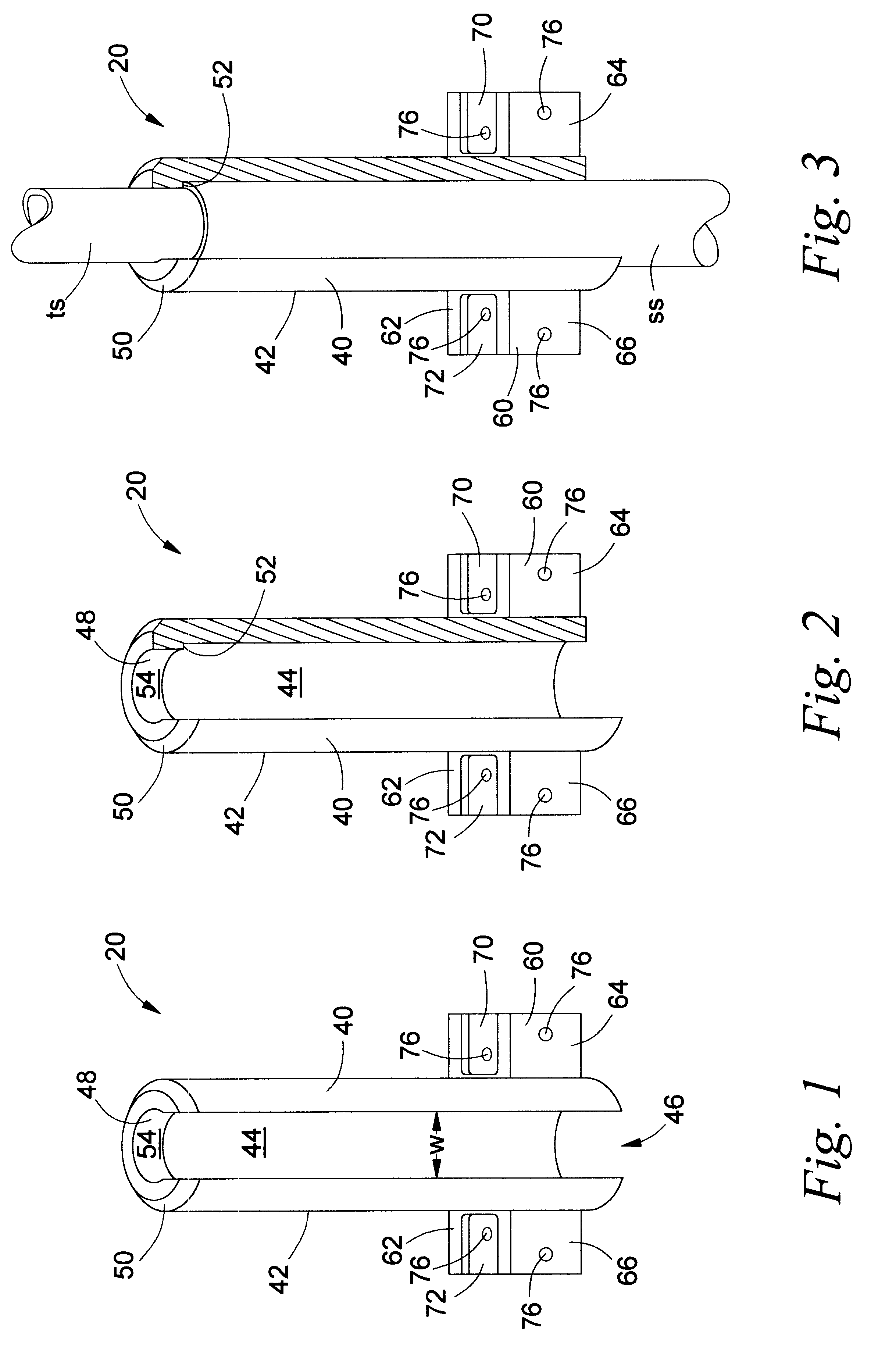 Accessory mount for an extendable shaft