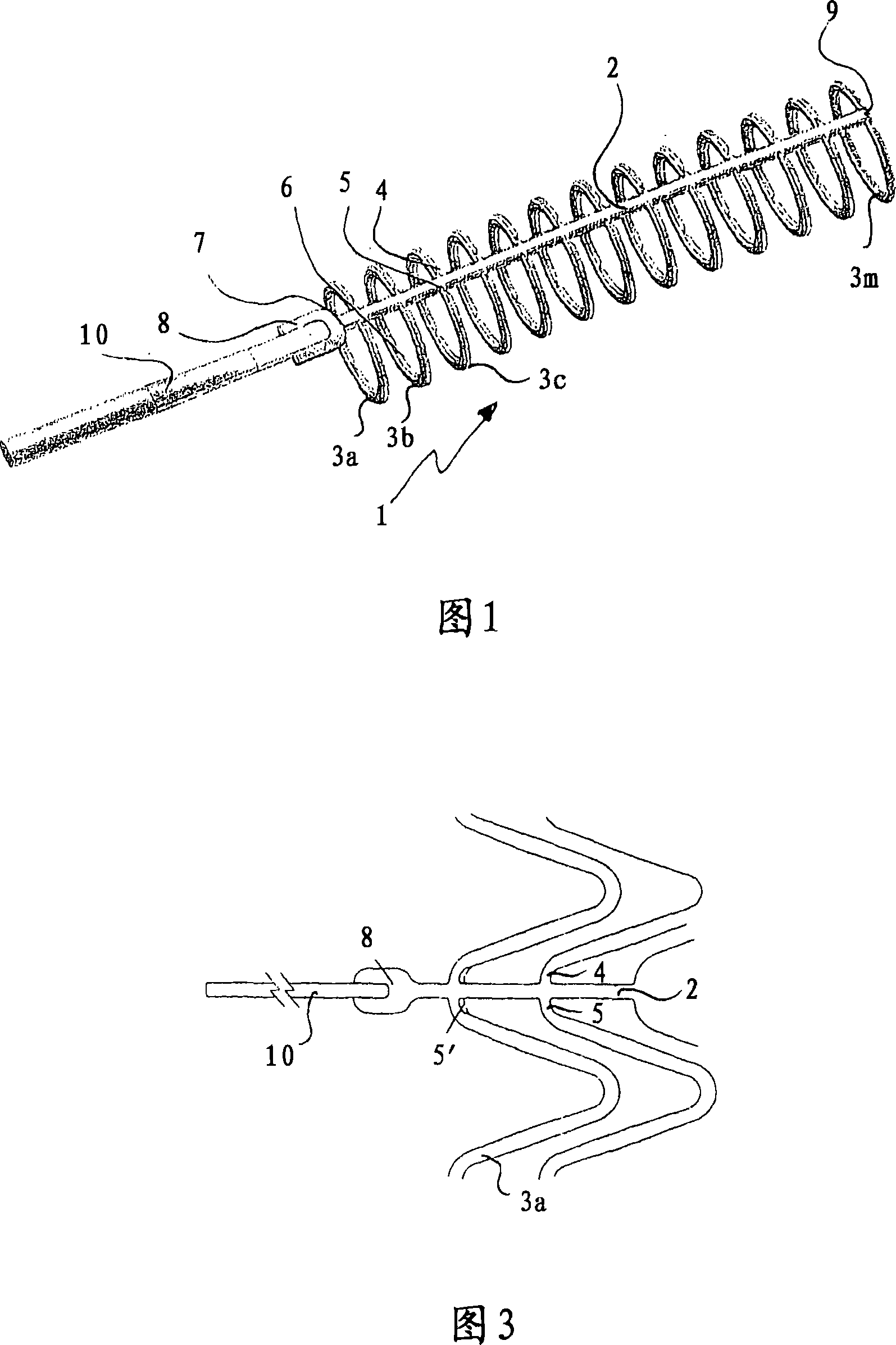 Temporary stent