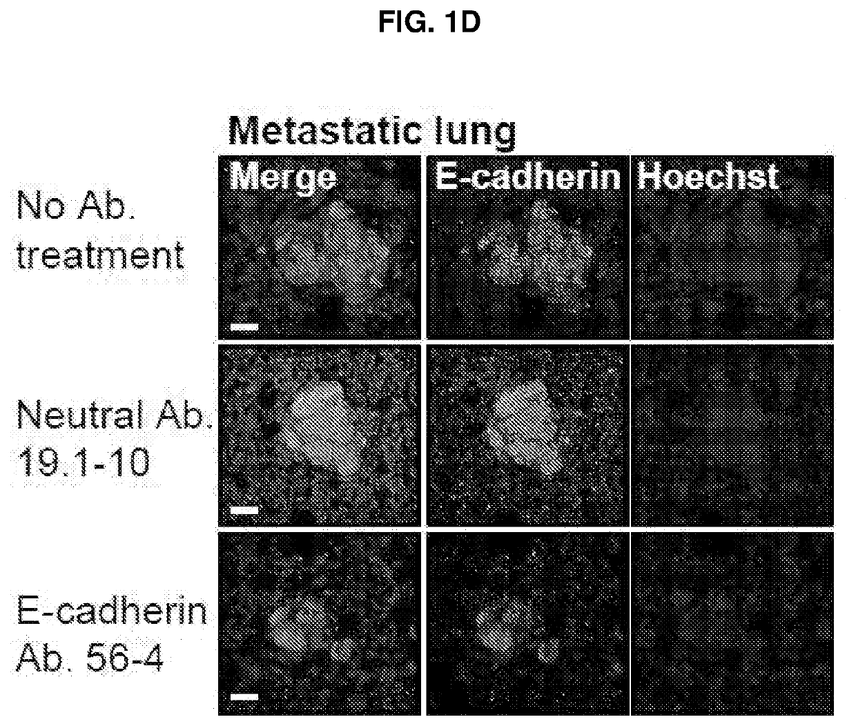 E-cadherin activating antibodies and uses thereof