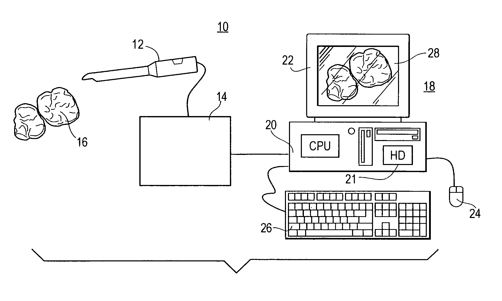 Automatic crown and gingiva detection from three-dimensional virtual model of teeth