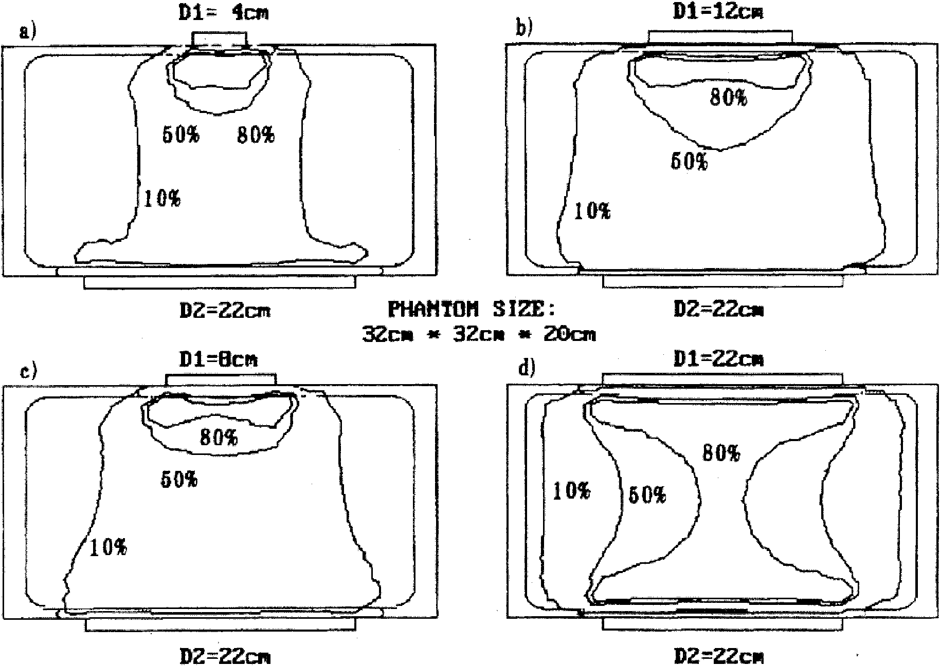 Radio frequency external electrode with variable electrode equivalent diameter, and radio frequency heat treatment device