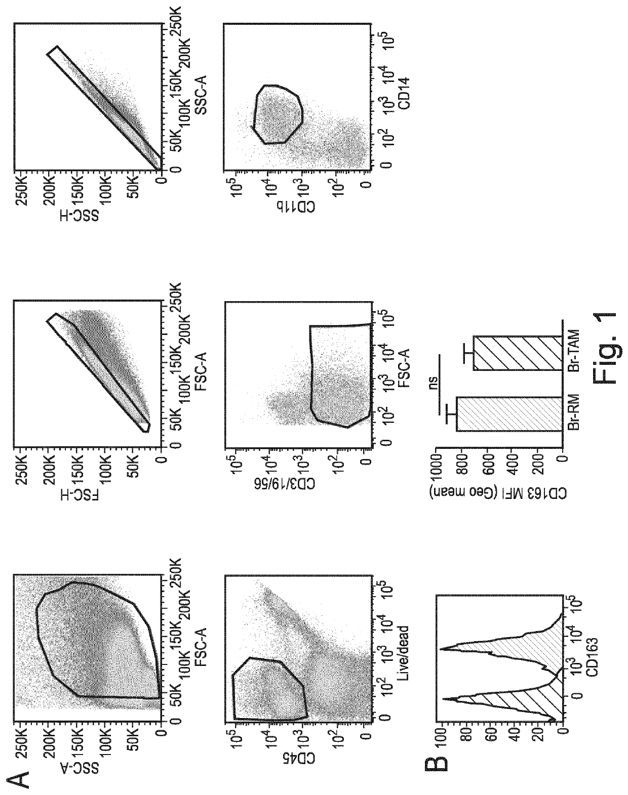 Macrophage expression in breast cancer