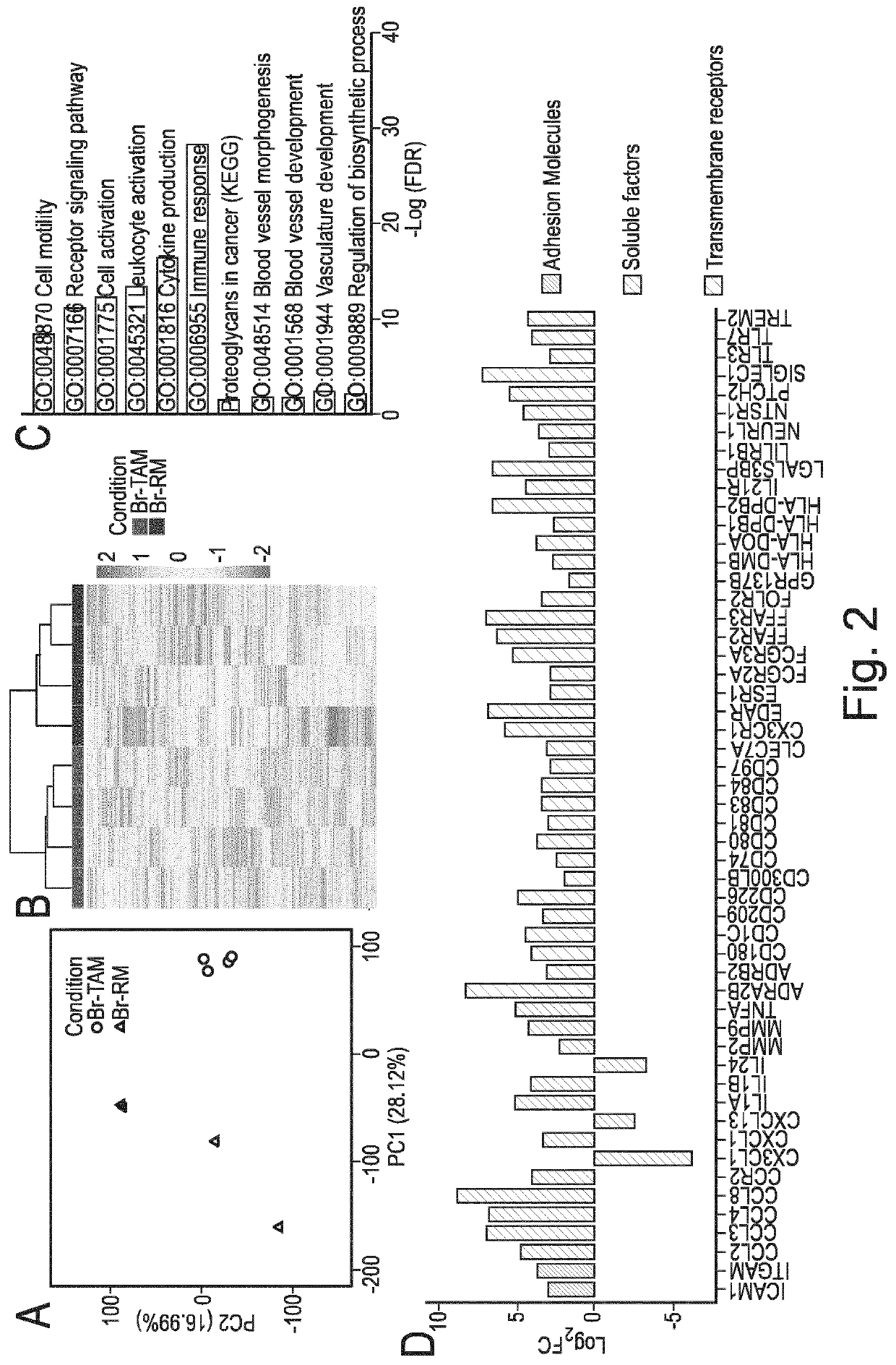 Macrophage expression in breast cancer