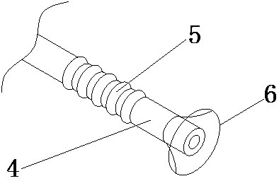 A repairing device for antique architectural aluminum components