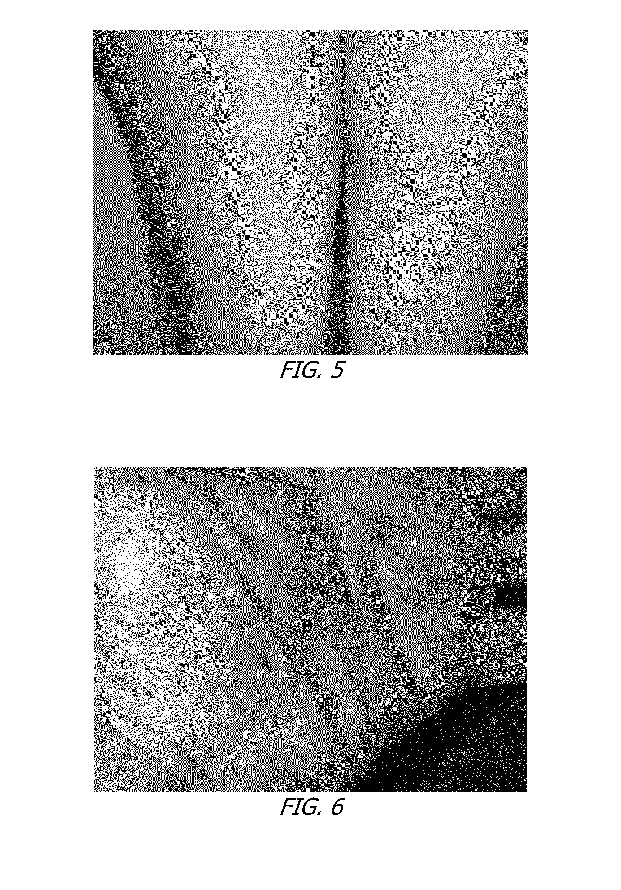 Methods and compositions of cannabis extracts