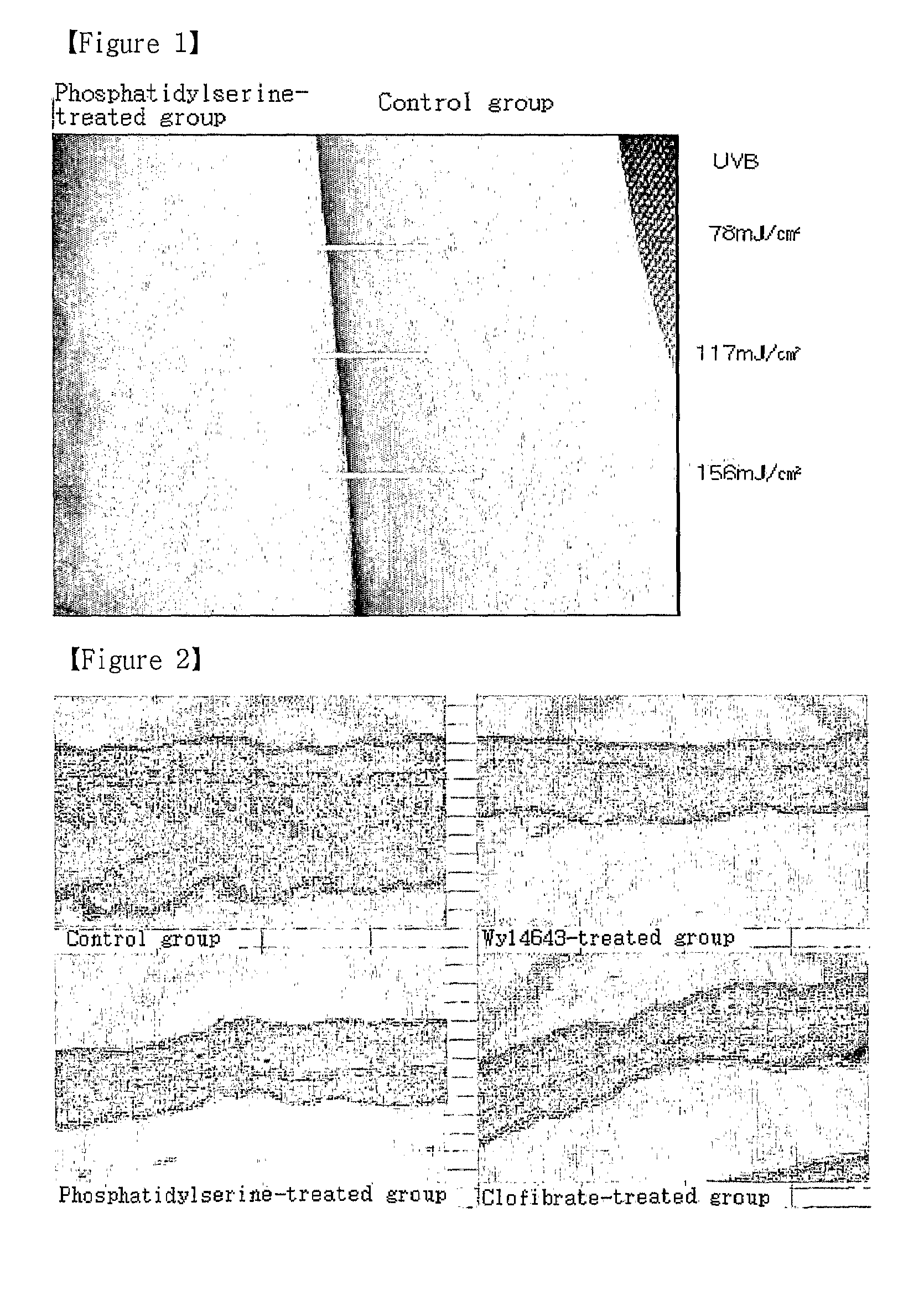 Composition for Protection and Improvement of Skin, or Reinforcing Skin Barrier Function Comprising Phosphatidylserine