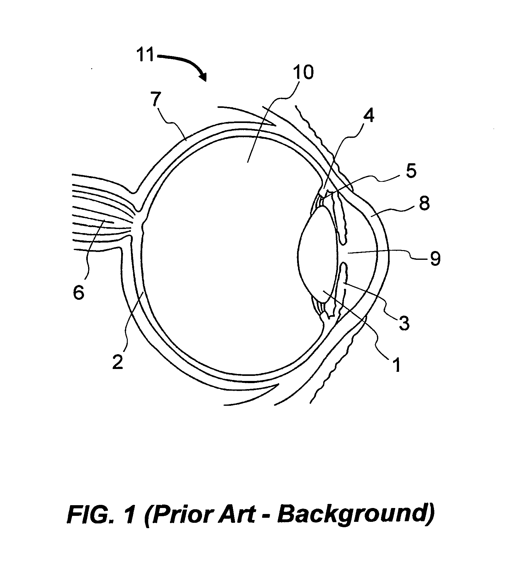 Method and apparatus to produce re-focusable vision by direct retinal projection with mirror array