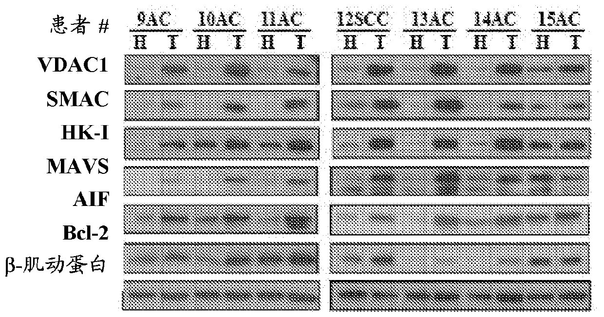 Biomarkers for diagnosis of lung cancer