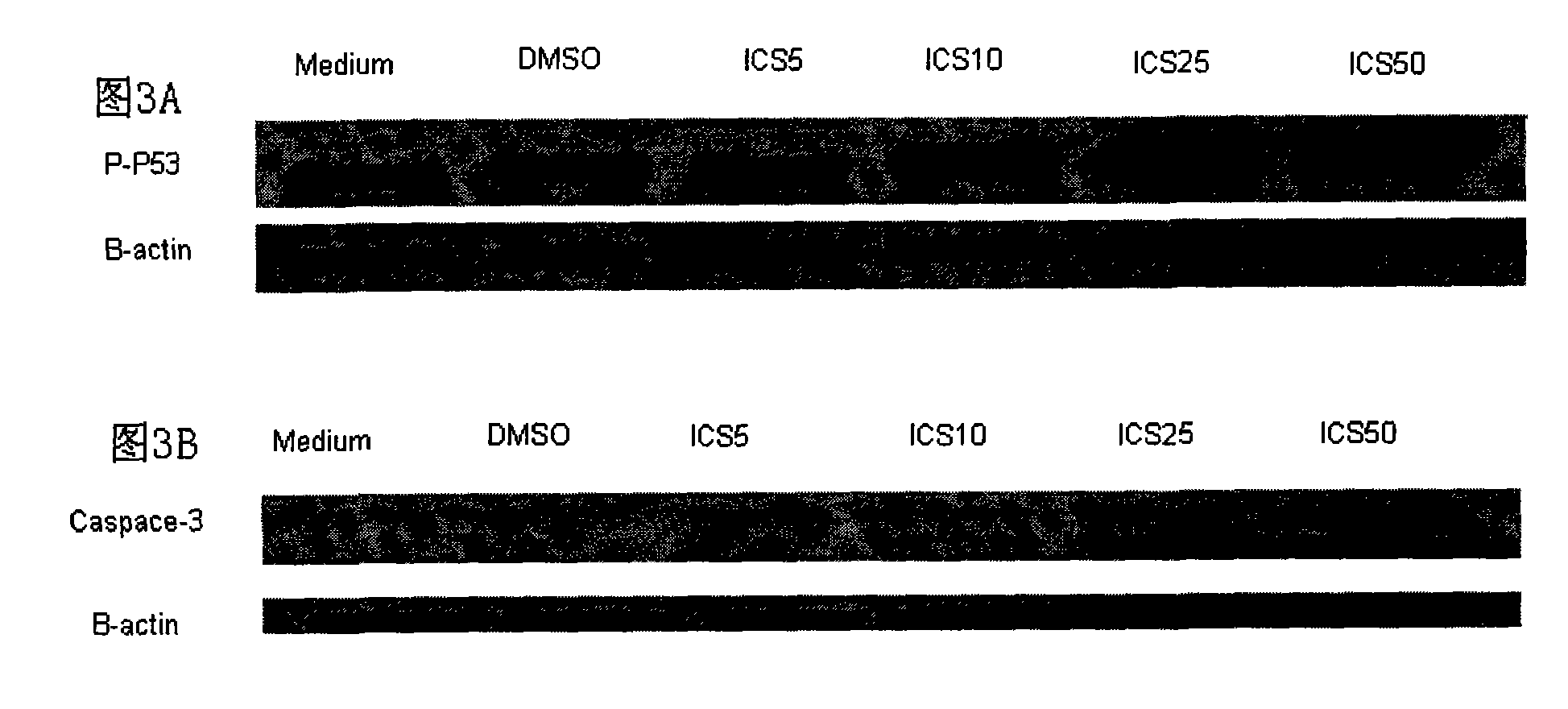 Application of icariside II in preparation of anti-melanoma medicament