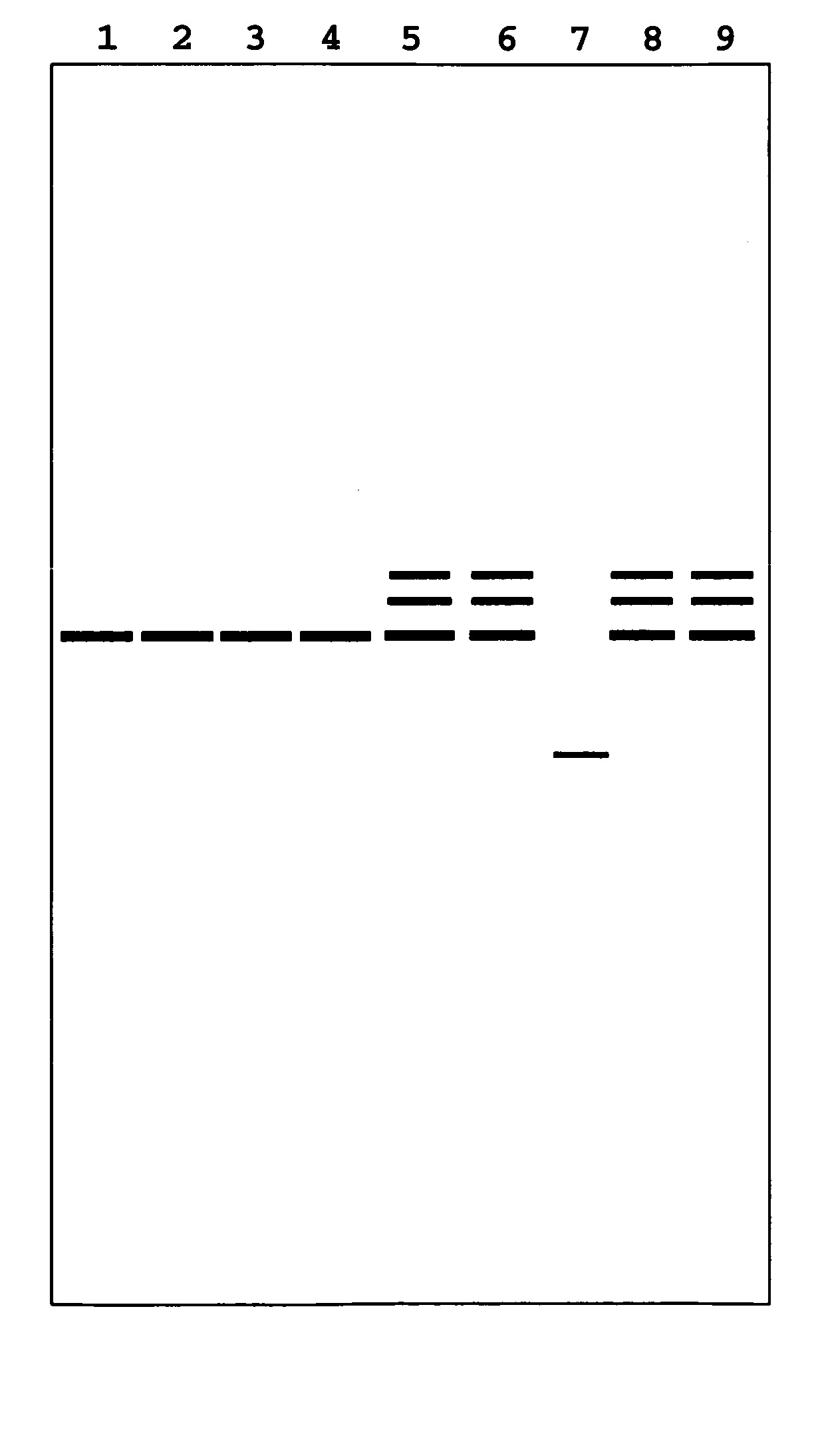 Mutation within the connexin 26 gene responsible for prelingual non-syndromic deafness and method of detection