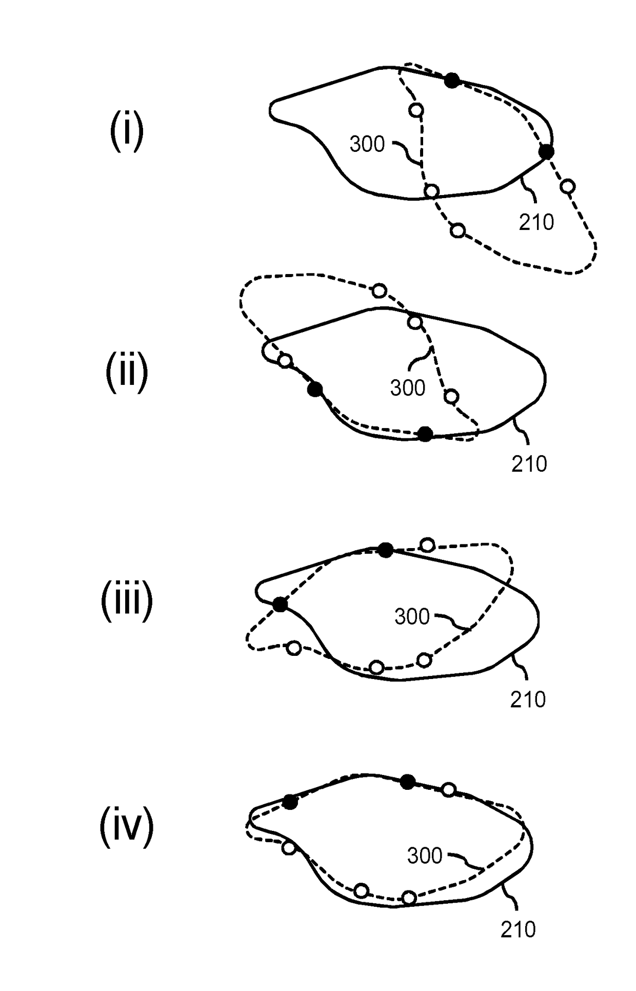 Model-based segmentation of an anatomical structure