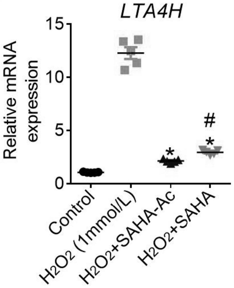 Application of nano-micelle-hydrogel preparation of HDAC inhibitor with double targets in medicine for treating acute kidney injury