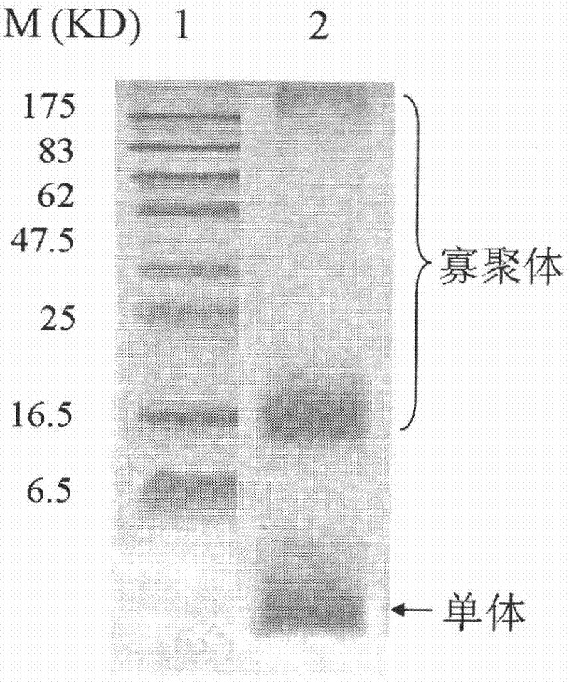 Anti-Alzheimer disease monoclonal antibody and application thereof