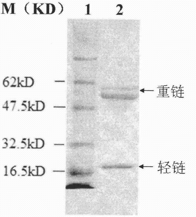 Anti-Alzheimer disease monoclonal antibody and application thereof