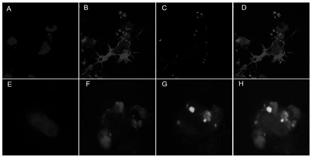 Lead compound of tumor treatment electric field, preparation method of lead compound and sensitization tumor treatment electric field