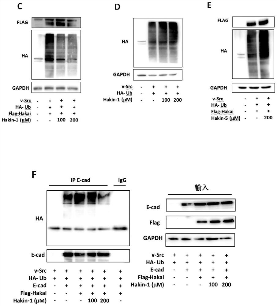 Compounds that selectively and effectively inhibit hakai-mediated ubiquitination, as Anti-cancer drugs