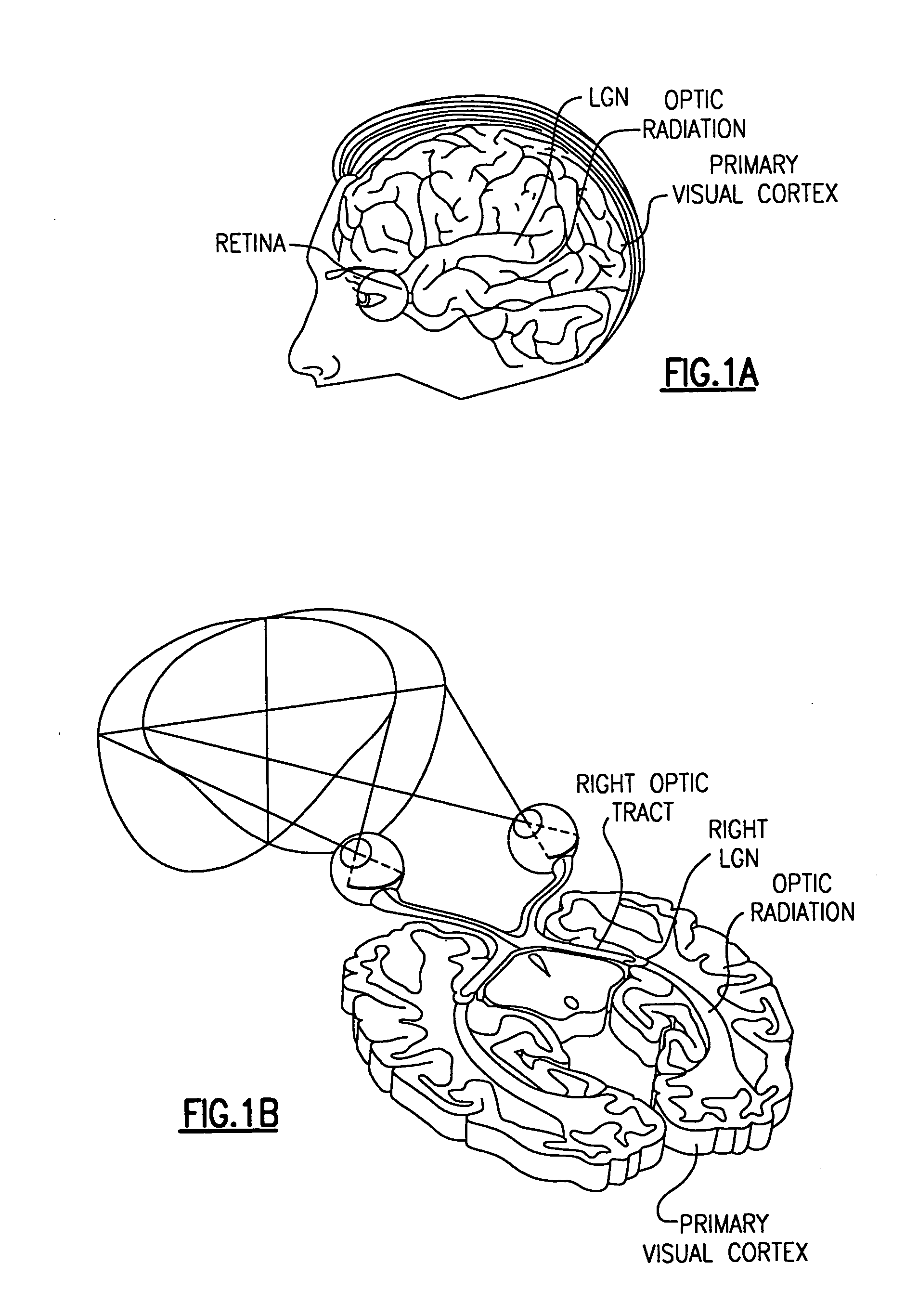 Apparatus and method for diagnosis of optically identifiable ophthalmic conditions