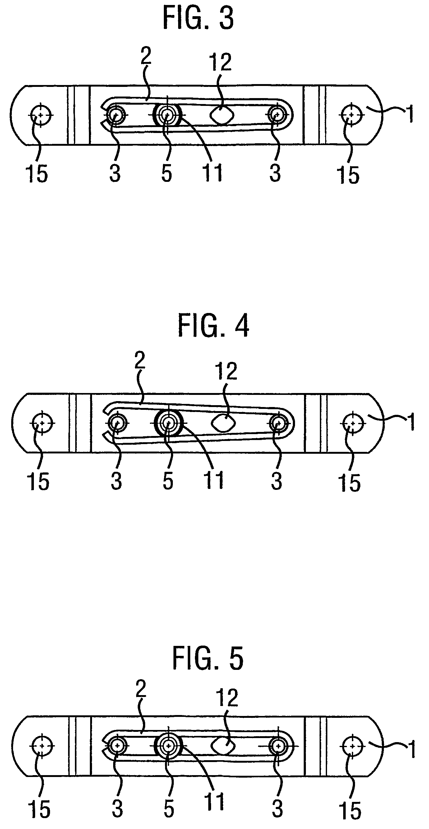 Restricting device