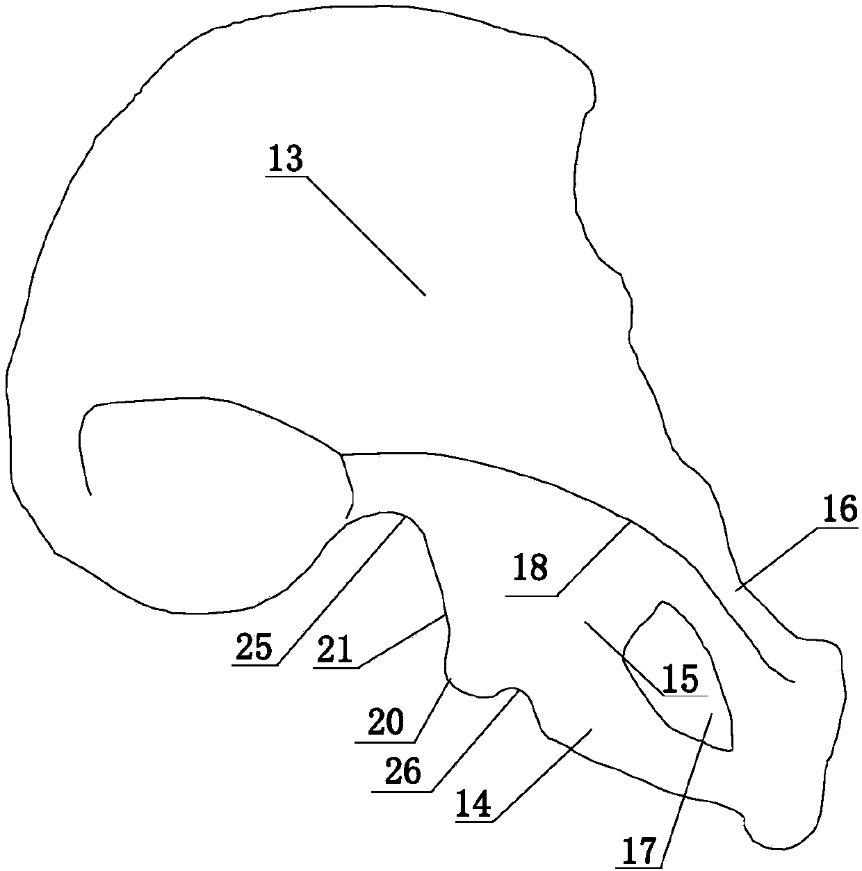 Fixation devices for acetabular anterior and posterior column fractures