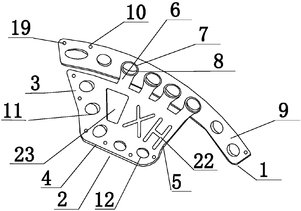 Fixation devices for acetabular anterior and posterior column fractures