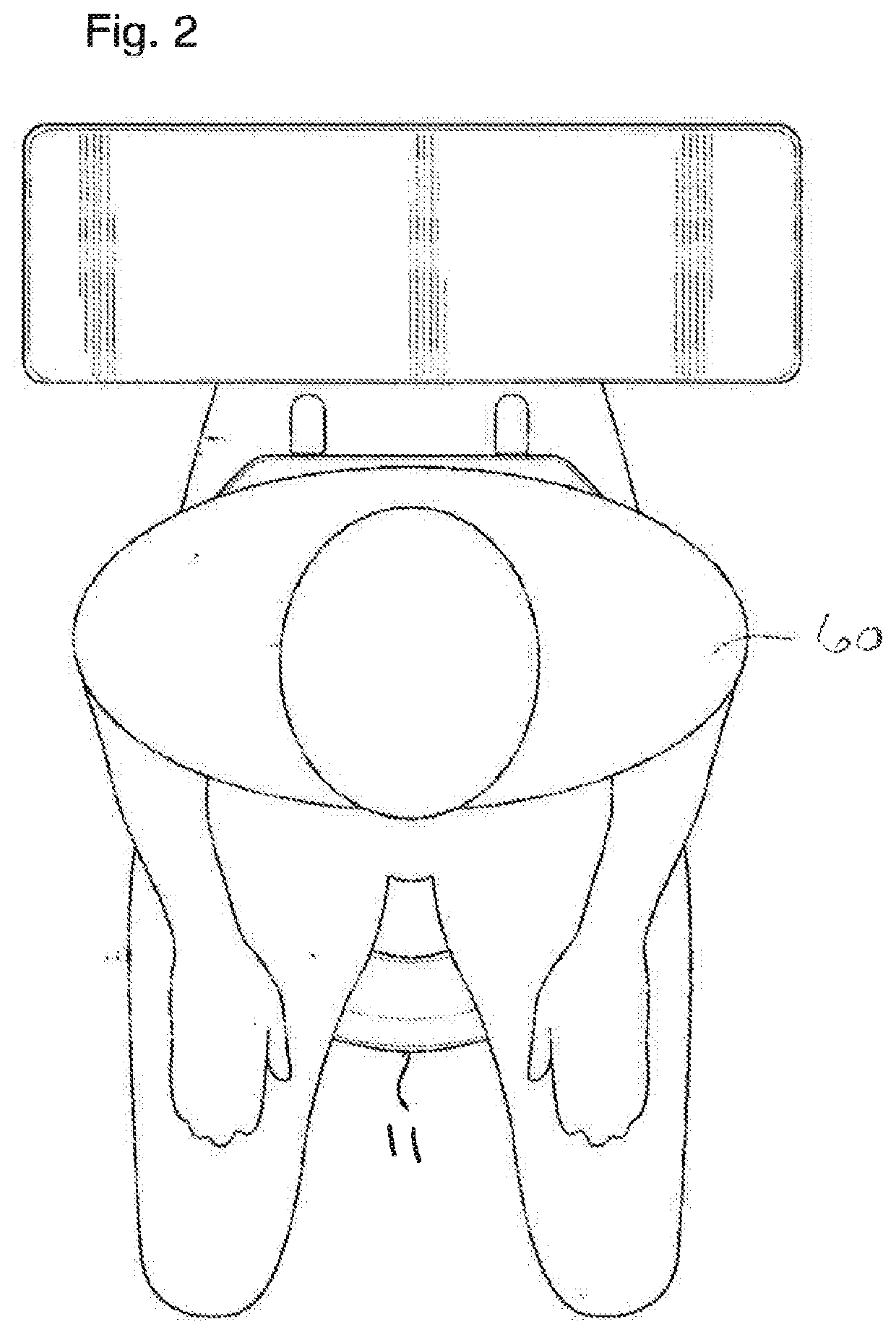 Urine deflector