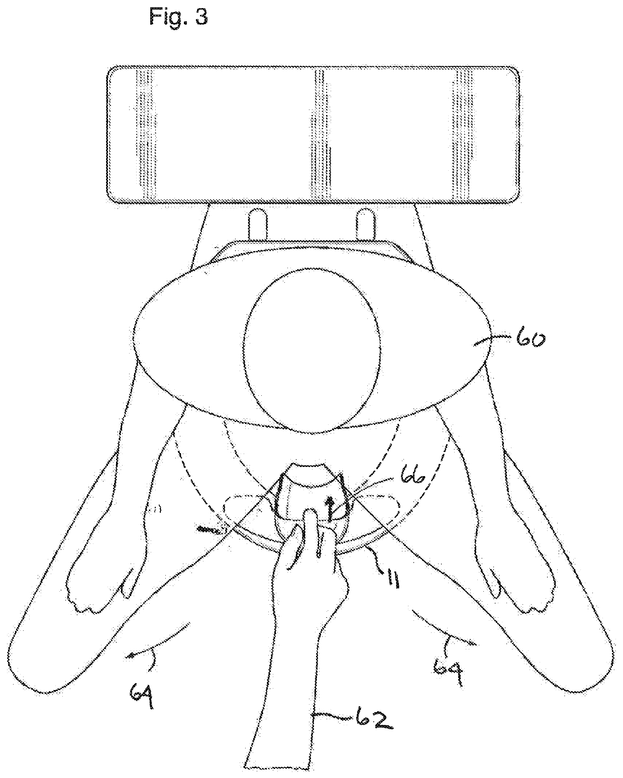 Urine deflector