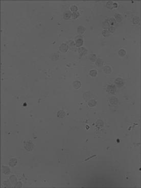 In situ hybridization detection kit for mRNA level at precancerous stage of breast cancer, detection method and application thereof