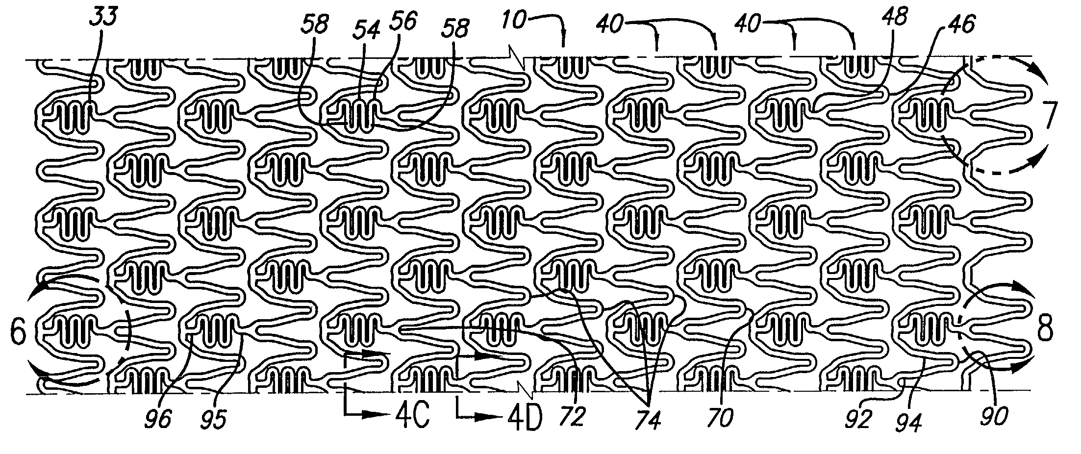 Hybrid stent and method of making