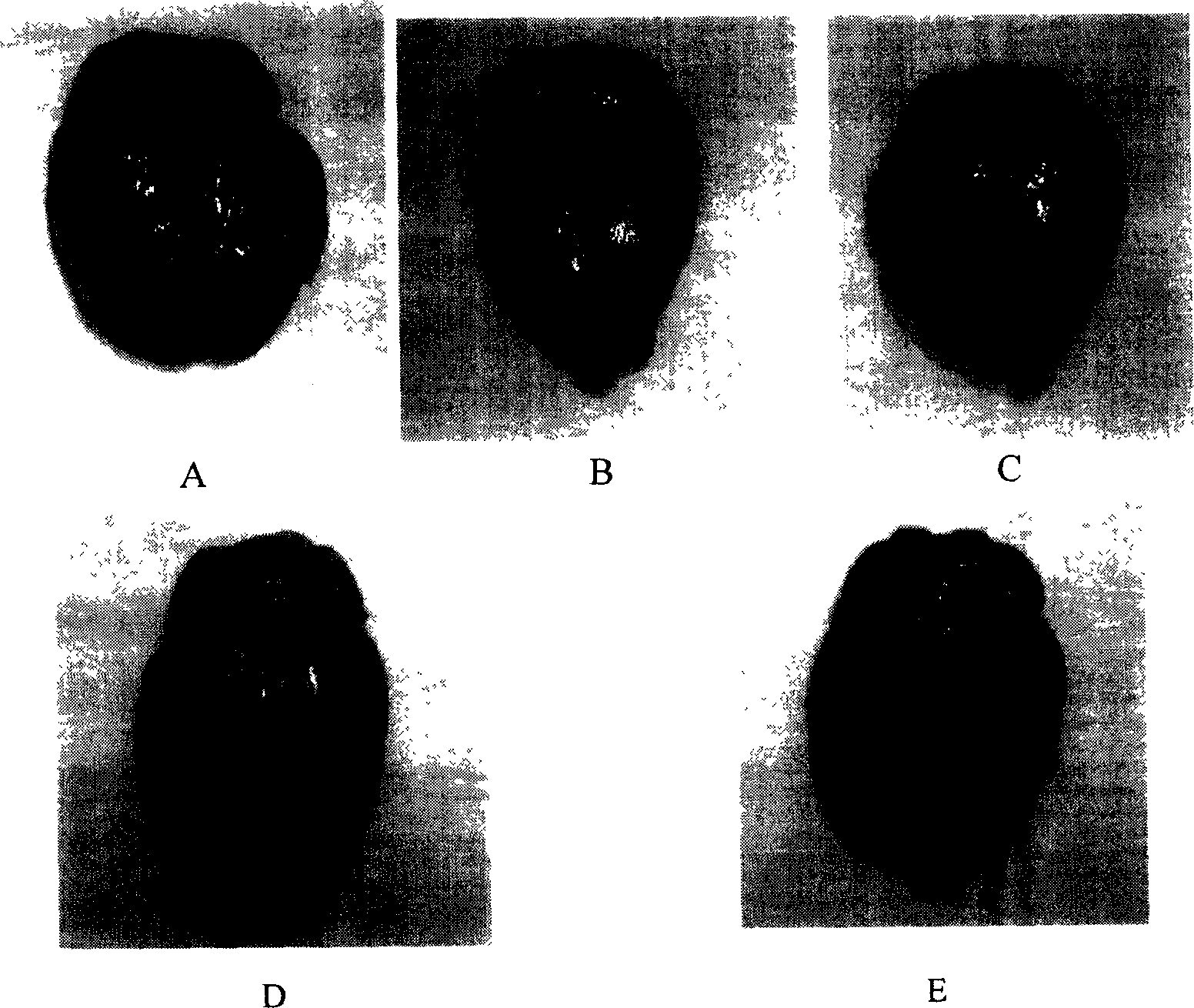 Application of alpha cyclo-alanine in the process for preparing medicine to treat cerebrovascular and cardiovascular disease