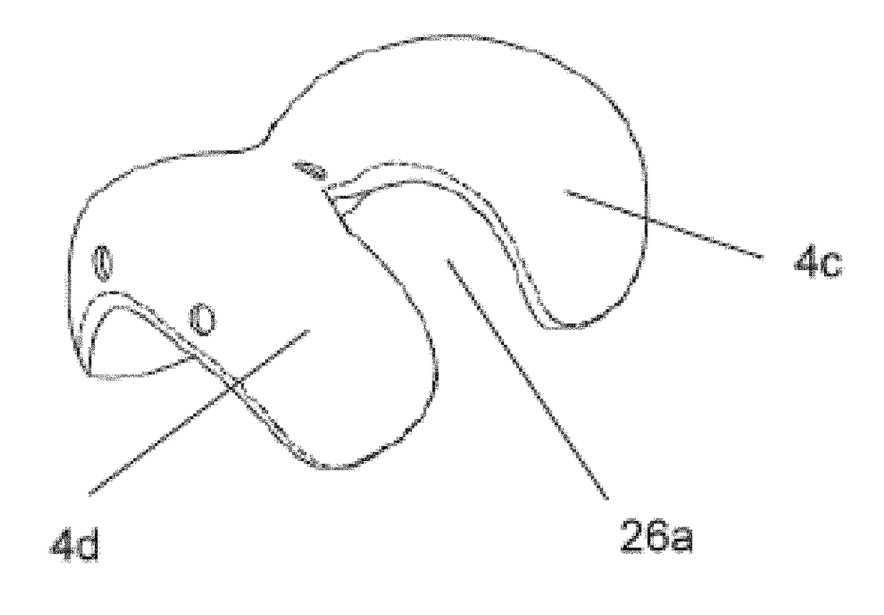 Resilient knee implant and methods