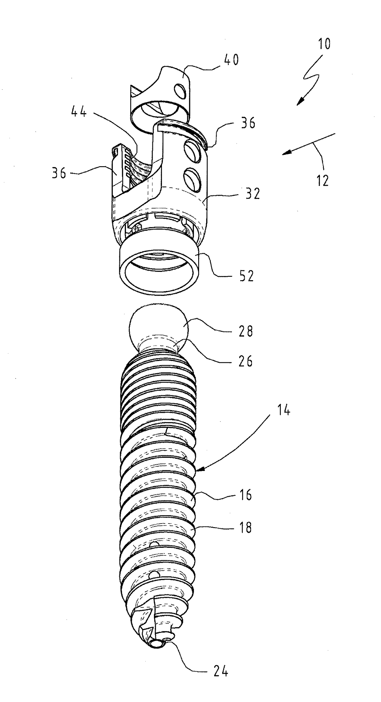 Osteosynthesis device