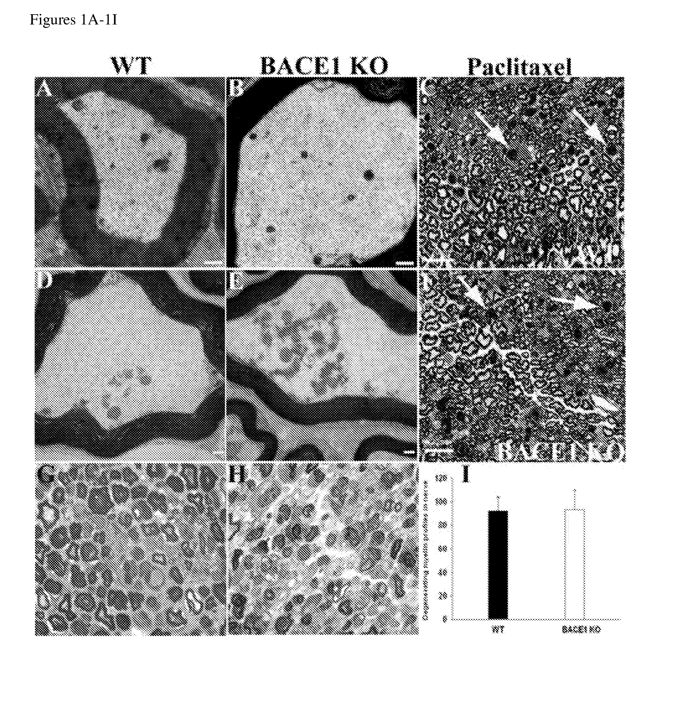 Methods for enhancing axonal regeneration