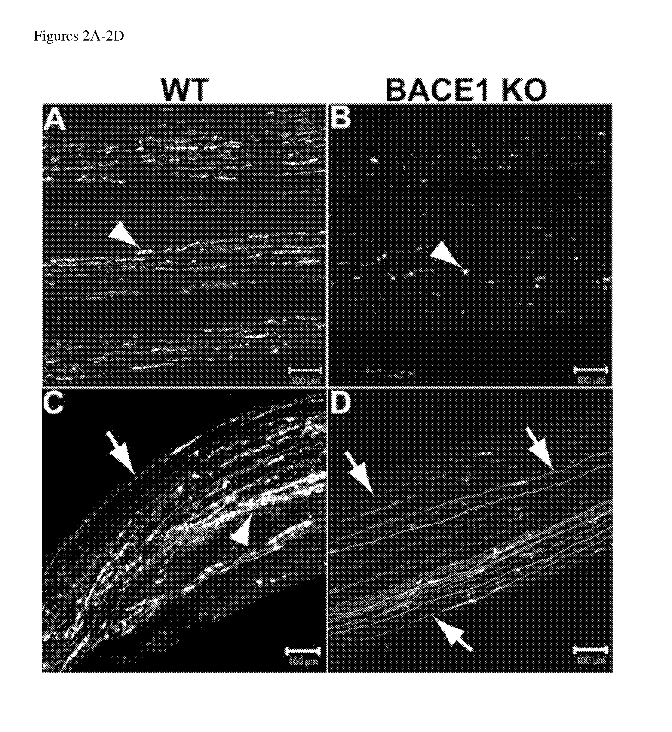 Methods for enhancing axonal regeneration