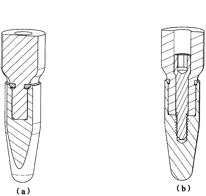 Tooth implant