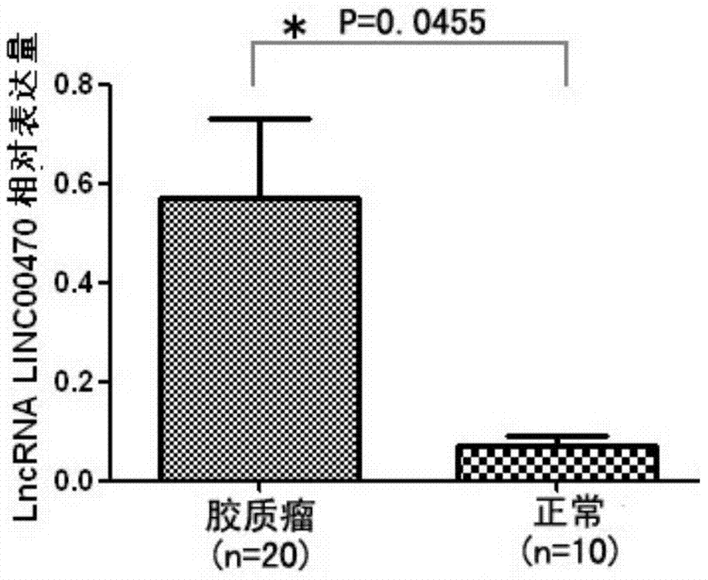 Application method of long non-coding RNA LINC00470 derived from serum exosomes