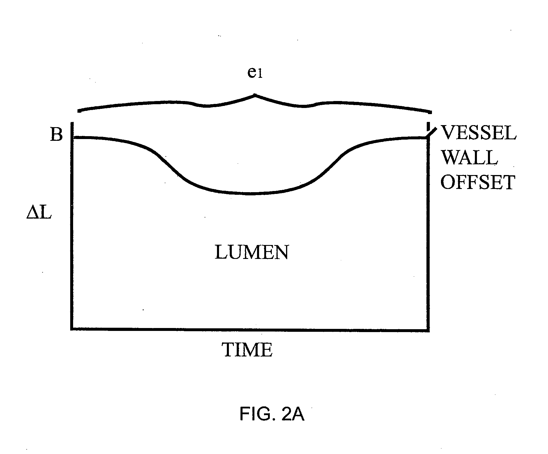 Method and Apparatus for Improving Image Clarity and Sensitivity in Optical Tomography Using Dynamic Feedback to Control Focal Properties and Coherence Gating