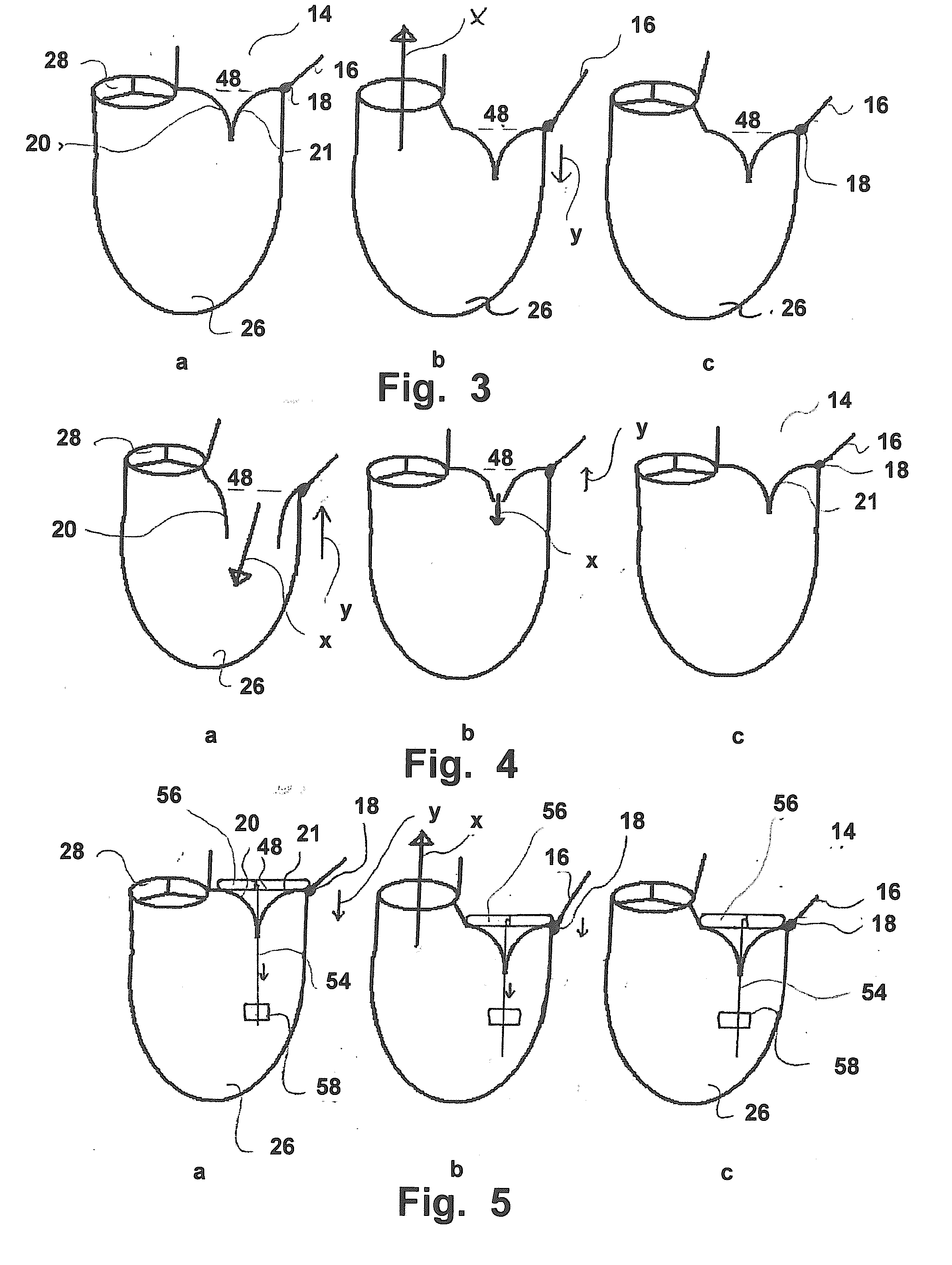 Device And A Method For Augmenting Heart Function