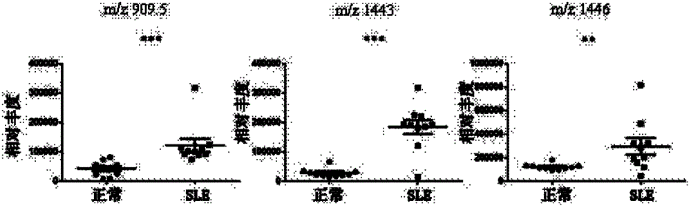 Diagnostic marker for systemic lupus erythematosus