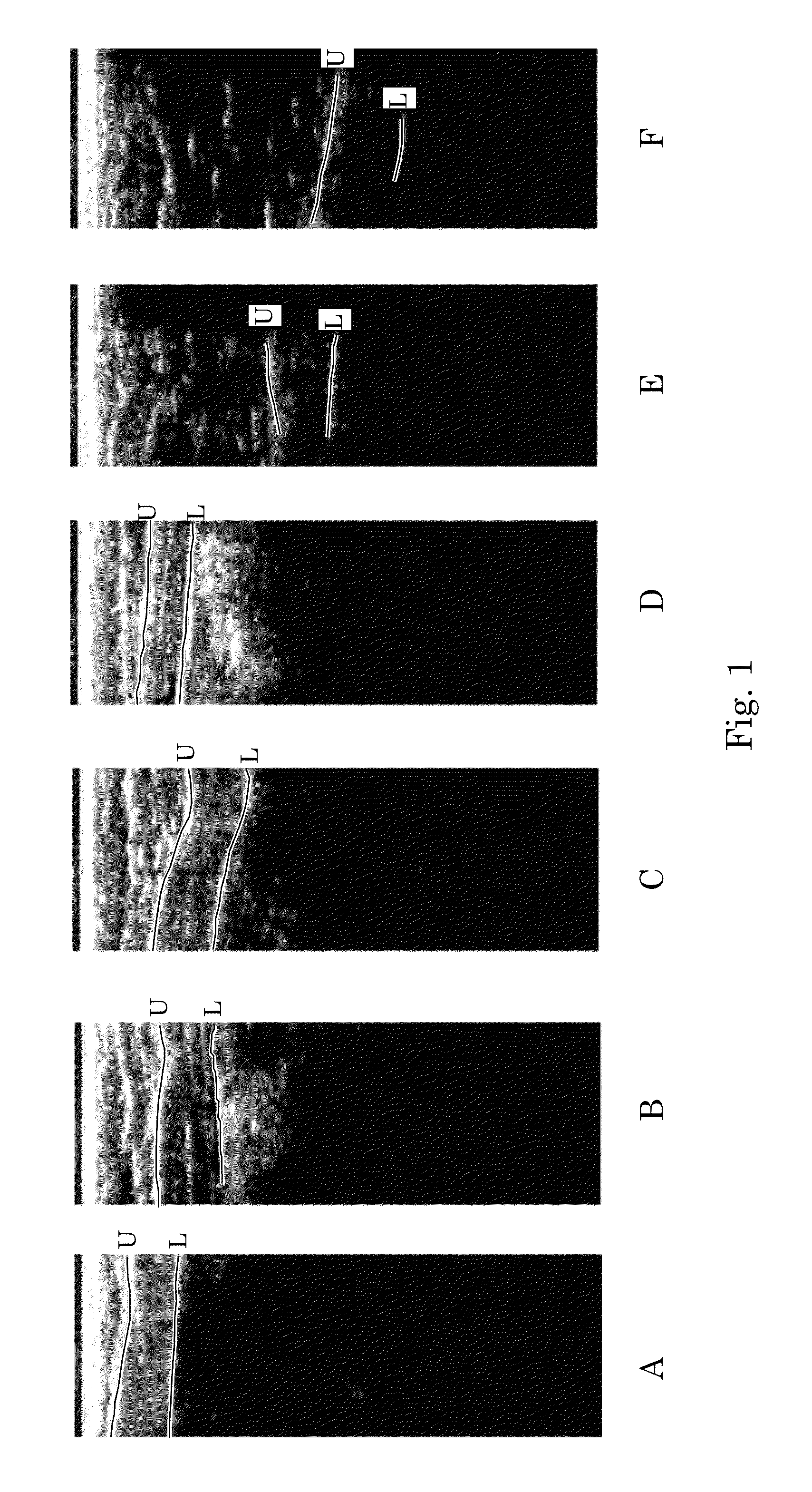 Orientation-aware average intensity histogram to indicate object boundary depth in ultrasound images