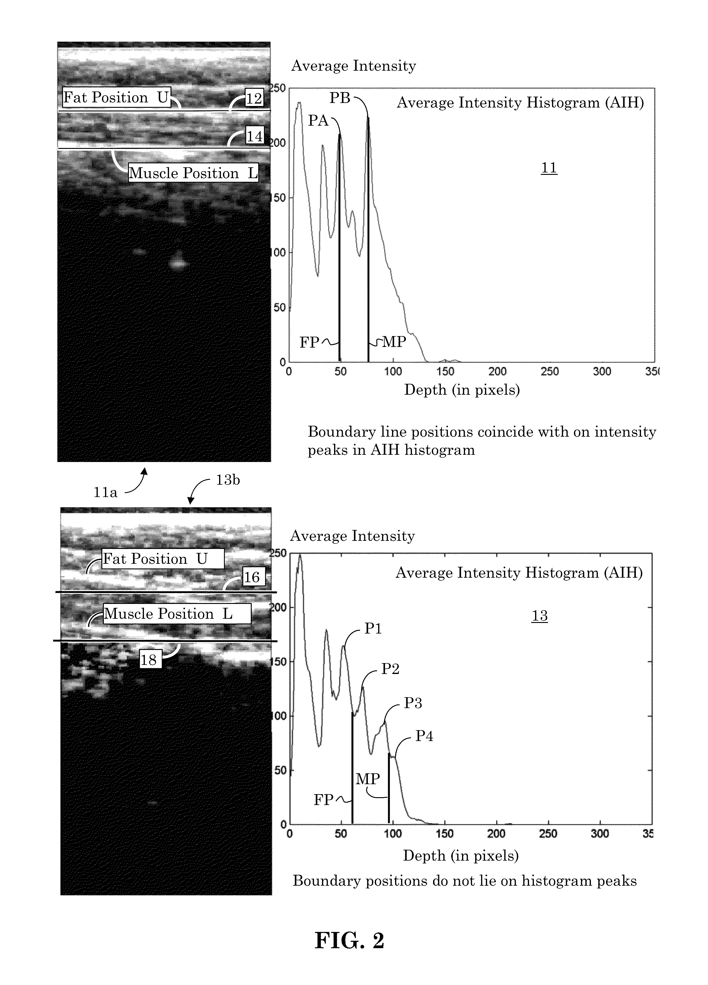 Orientation-aware average intensity histogram to indicate object boundary depth in ultrasound images