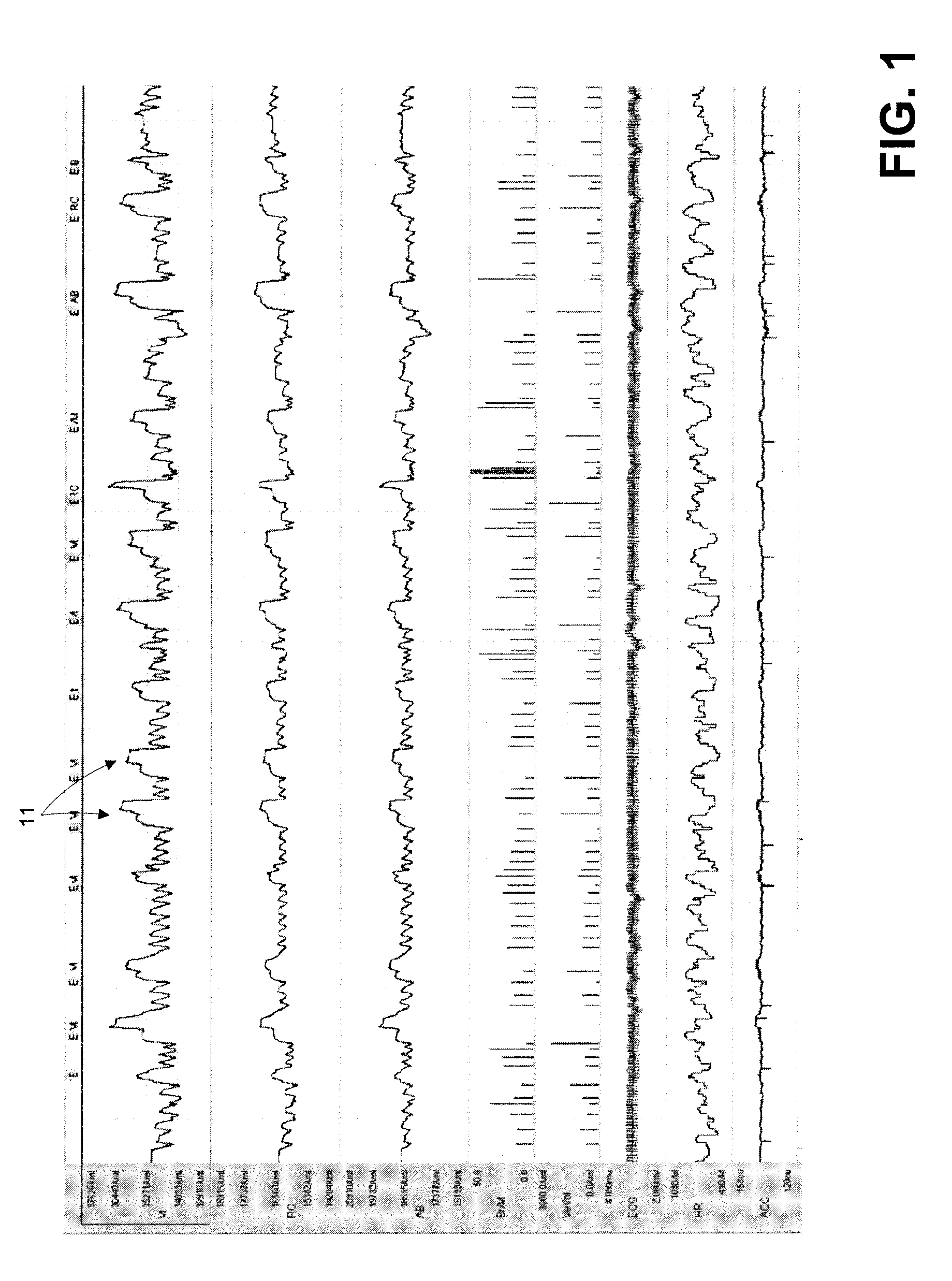 Monitoring and quantification of smoking behaviors