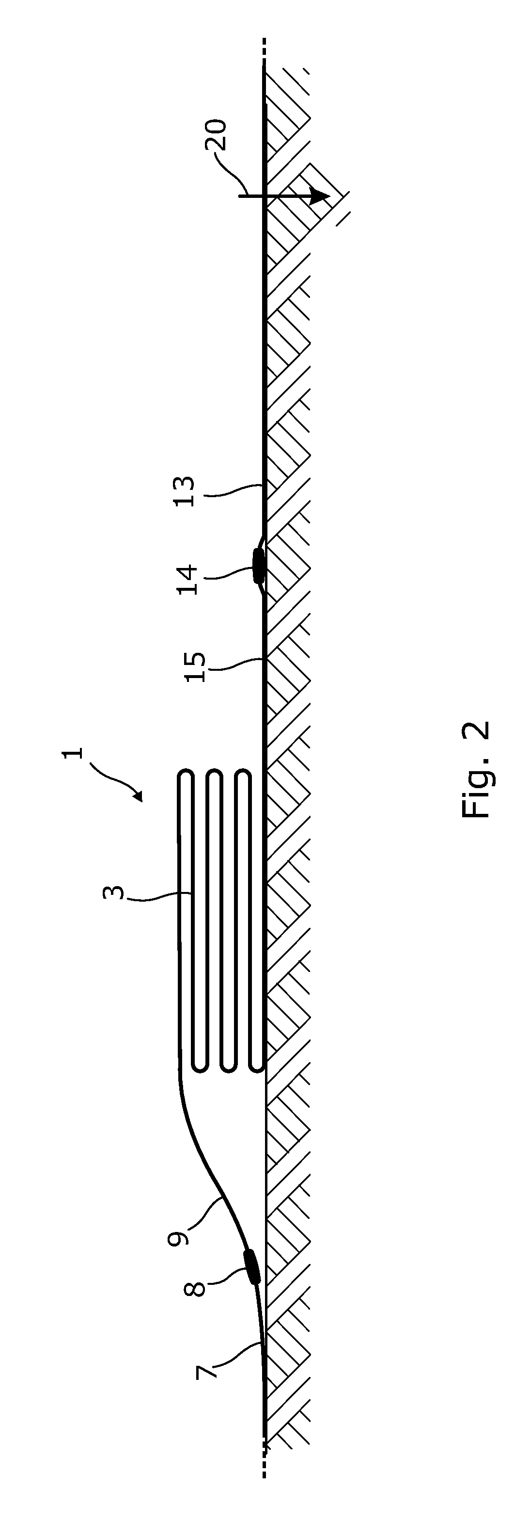 Load-Limiting Devices