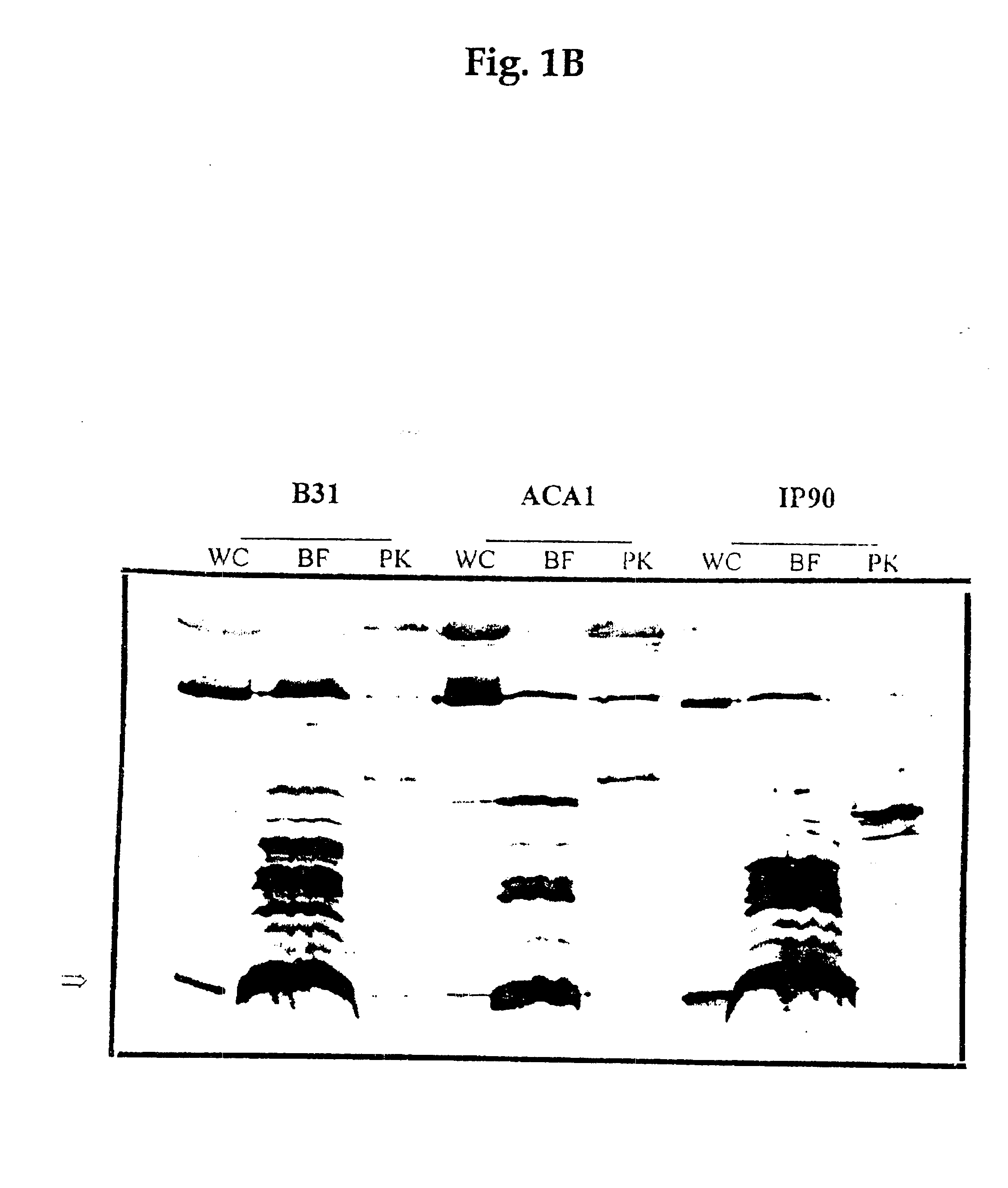 P13 antigens from Borrelia