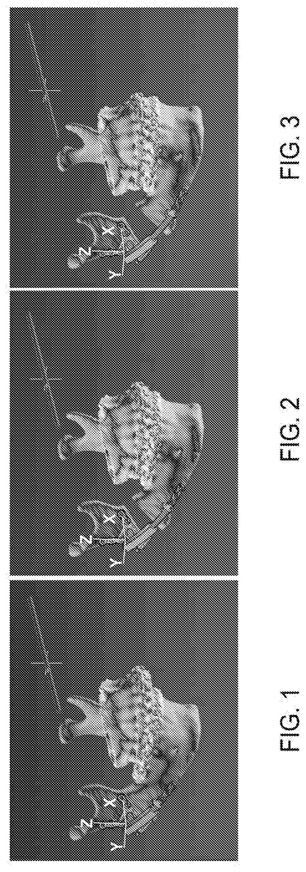 Customizable helical telescoping internal craniofacial distractor