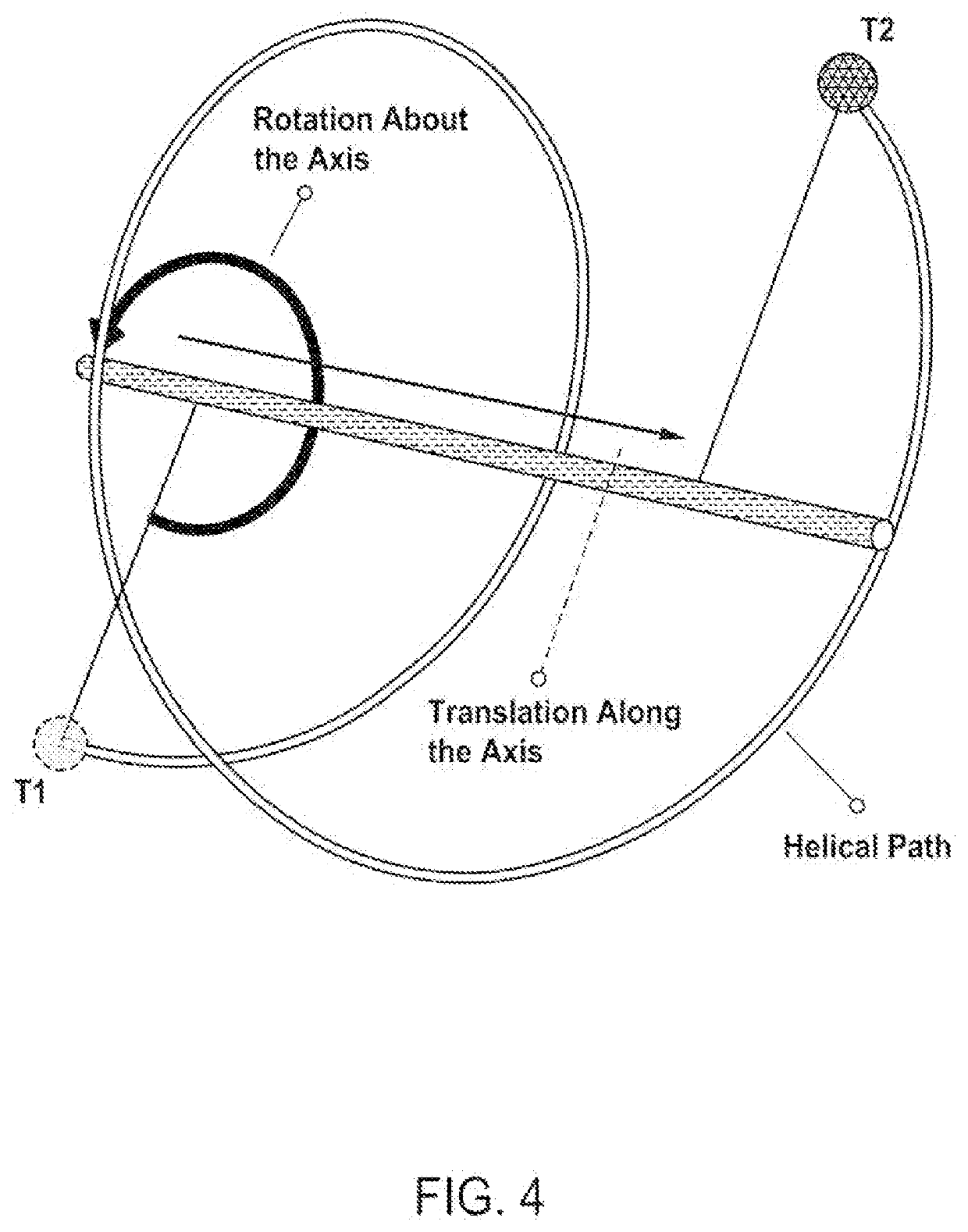 Customizable helical telescoping internal craniofacial distractor