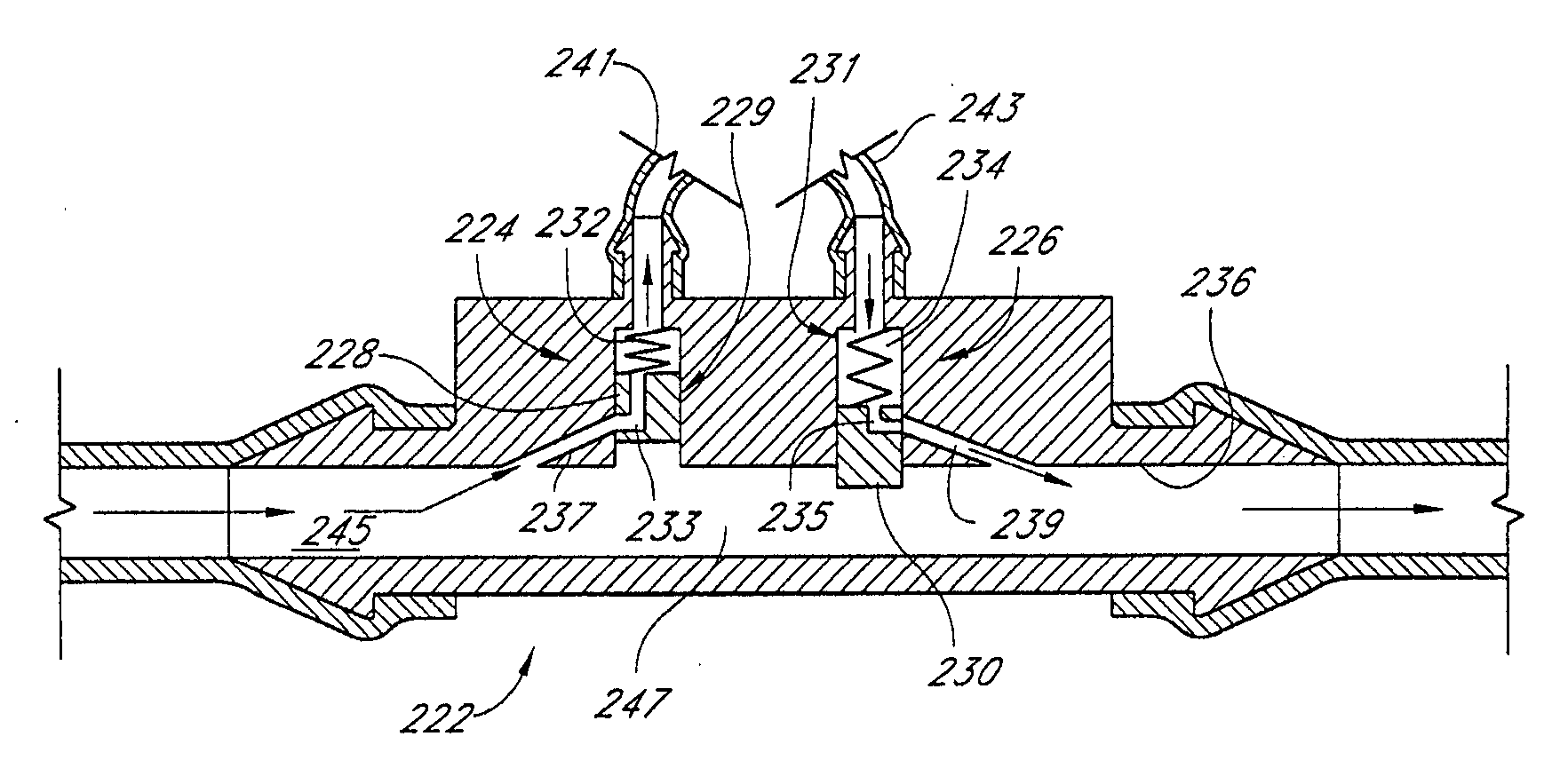 Self-sealing residual compressive stress graft for dialysis