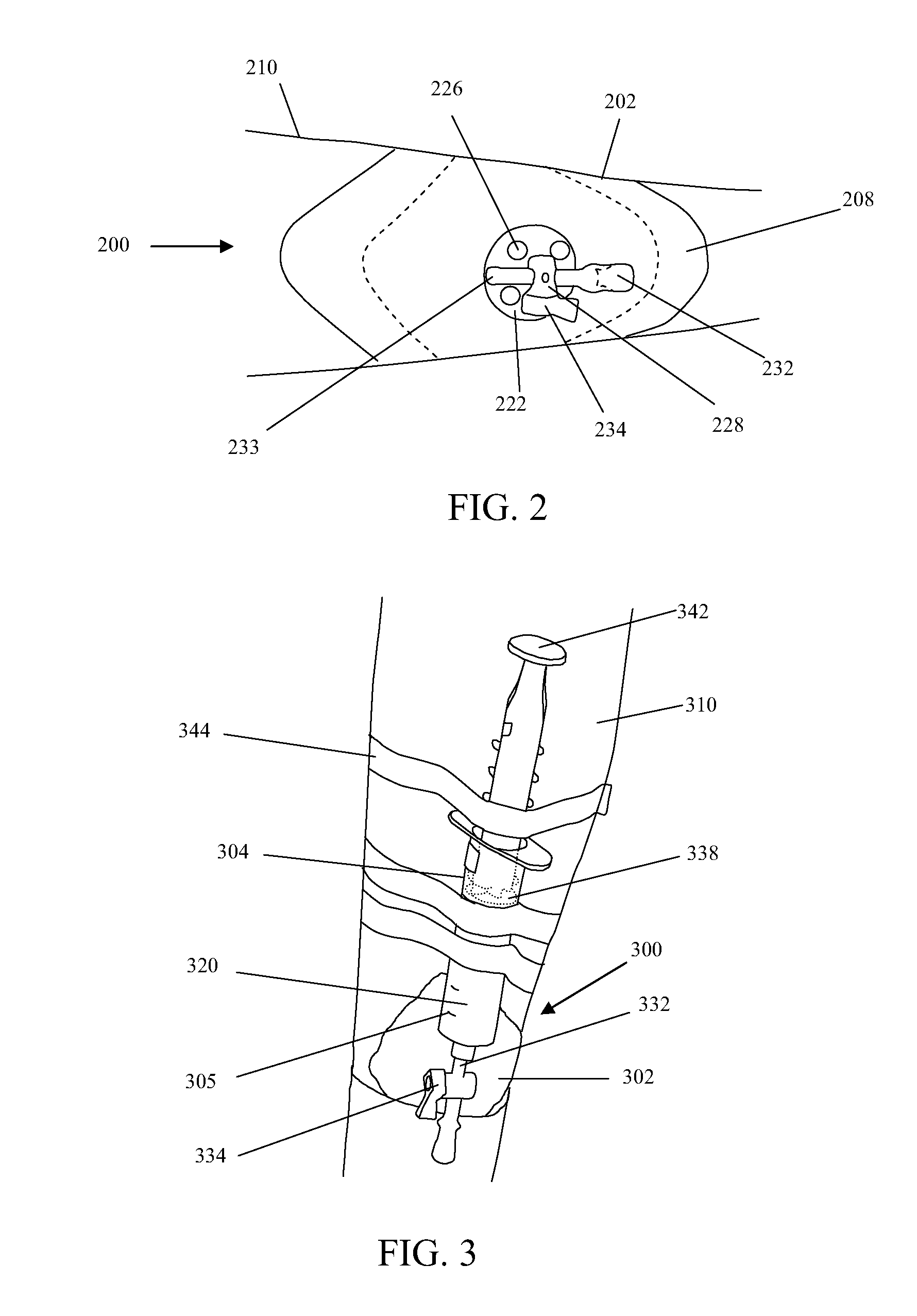 Methods for application of reduced pressure therapy