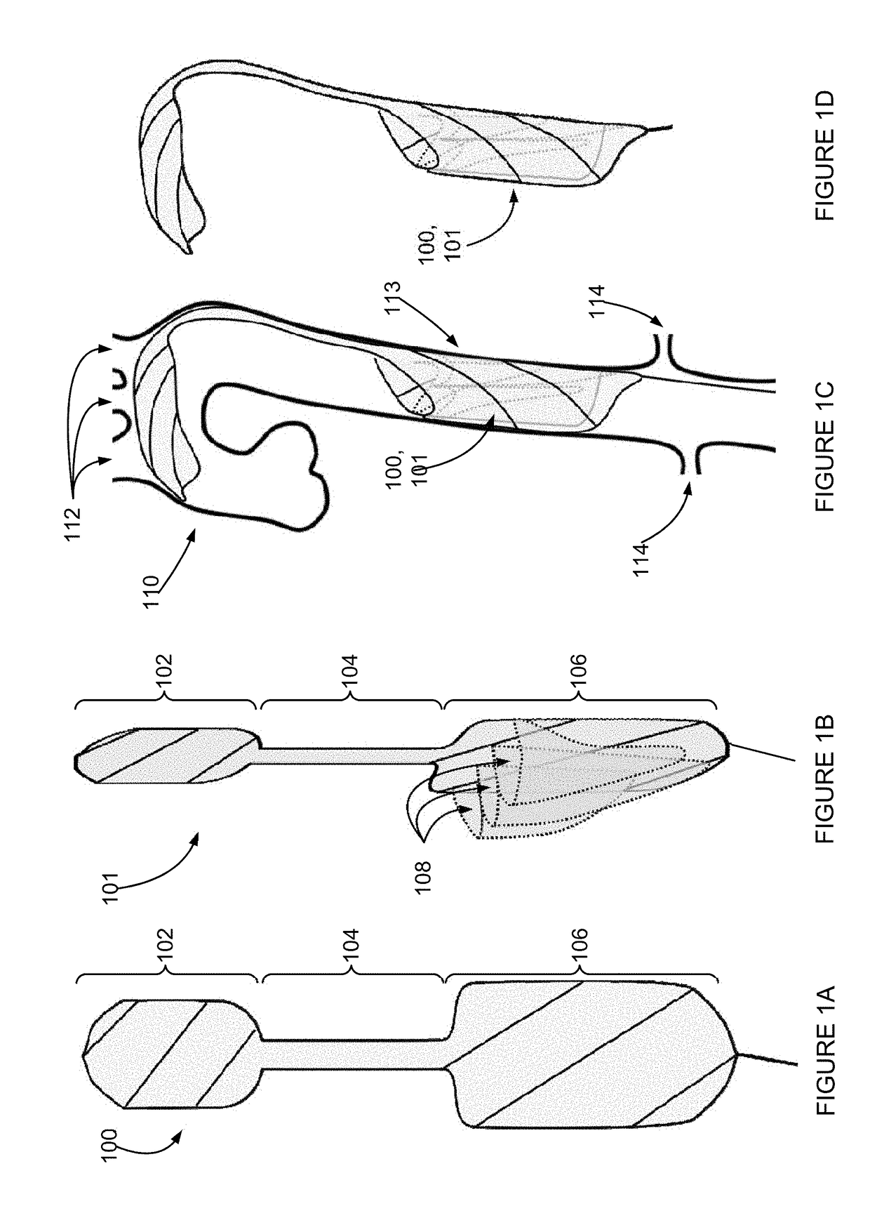 Intra-aortic emboli protection filter device